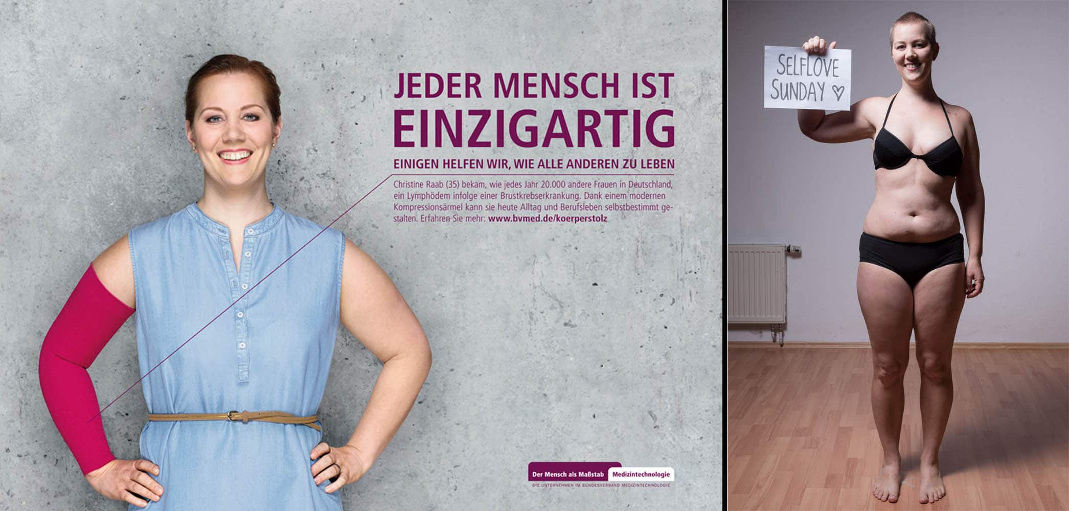BVmed, Kampagne, körperstolz, Lymphödem, Brustkrebs, Blogger, Öffentlichkeitsarbeit, Selflove Sunday, I love Spa