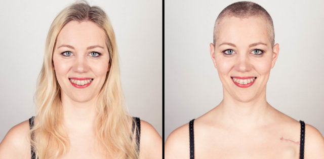 haare ab, vorher, nachher, krebs, chemotherapie